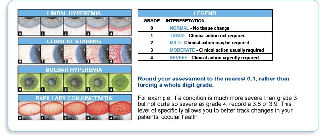 Grading scales